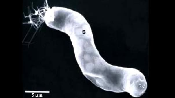 Bacterium Titanospirillum Velox