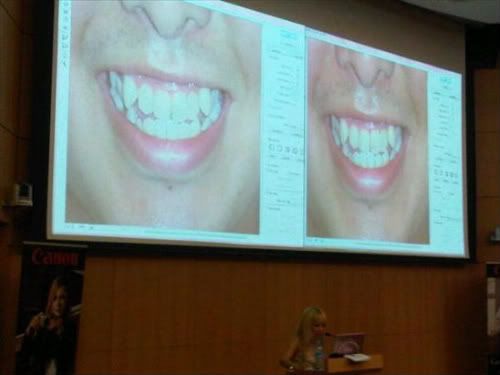 Xiaxue photoshopping teeth